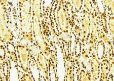 GSK3B / GSK3 Beta Antibody - 1:100 staining mouse kidney tissue by IHC-P. The sample was formaldehyde fixed and a heat mediated antigen retrieval step in citrate buffer was performed. The sample was then blocked and incubated with the antibody for 1.5 hours at 22°C. An HRP conjugated goat anti-rabbit antibody was used as the secondary.