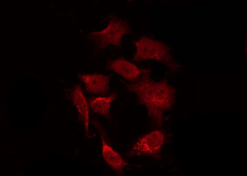 GSK3B / GSK3 Beta Antibody - Staining HuvEc cells by IF/ICC. The samples were fixed with PFA and permeabilized in 0.1% Triton X-100, then blocked in 10% serum for 45 min at 25°C. The primary antibody was diluted at 1:200 and incubated with the sample for 1 hour at 37°C. An Alexa Fluor 594 conjugated goat anti-rabbit IgG (H+L) Ab, diluted at 1/600, was used as the secondary antibody.
