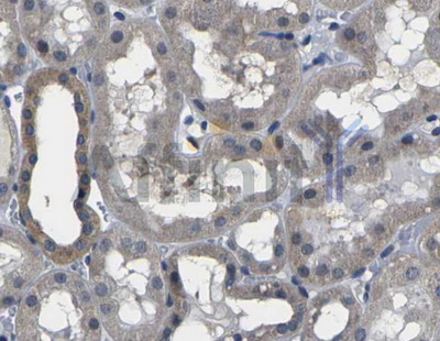 GSK3B / GSK3 Beta Antibody - 1/100 staining human kidney tissue by IHC-P. The sample was formaldehyde fixed and a heat mediated antigen retrieval step in citrate buffer was performed. The sample was then blocked and incubated with the antibody for 1.5 hours at 22°C. An HRP conjugated goat anti-rabbit antibody was used as the secondary antibody.