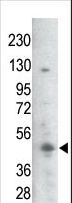 GSK3B / GSK3 Beta Antibody - The anti-Phospho-GSK3B-S21/29 antibody is used in Western blot to detect Phospho-GSK3B-S21/29 in mouse thymus tissue lysate.