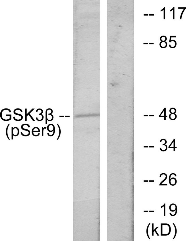 GSK3B / GSK3 Beta Antibody - Western blot analysis of lysates from HeLa cells treated with EGF, using GSK3 beta (Phospho-Ser9) Antibody. The lane on the right is blocked with the phospho peptide.