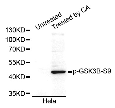 GSK3B / GSK3 Beta Antibody - Western blot analysis of extracts of HeLa cells.