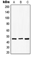 GSK3B / GSK3 Beta Antibody - Western blot analysis of GSK3 beta (pS9) expression in MCF7 (A); NIH3T3 (B); PC12 (C) whole cell lysates.