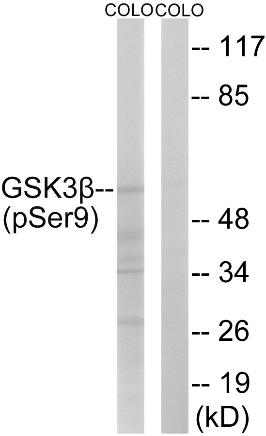 GSK3B / GSK3 Beta Antibody - Western blot of extracts from COLO, using GSK3 beta (Phospho-Ser9) Antibody.