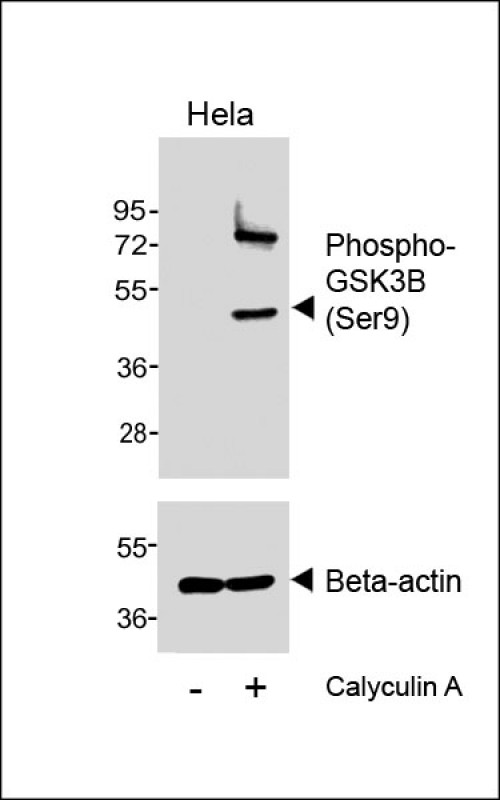 GSK3B / GSK3 Beta Antibody - Western blot analysis of lysates from Hela cell line, untreated or treated with Calyculin A, 100nM, 30min, using Phospho--GSK3B (Ser9) Antibody (upper) or Beta-actin (lower).