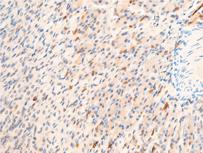 GSK3B / GSK3 Beta Antibody - 1:100 staining mouse gastric tissue by IHC-P. The tissue was formaldehyde fixed and a heat mediated antigen retrieval step in citrate buffer was performed. The tissue was then blocked and incubated with the antibody for 1.5 hours at 22°C. An HRP conjugated goat anti-rabbit antibody was used as the secondary.