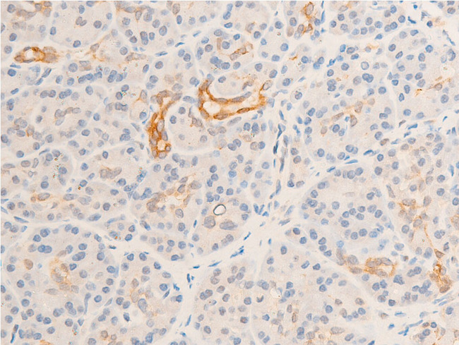 GSK3B / GSK3 Beta Antibody - 1:100 staining human pancreas tissue by IHC-P. The tissue was formaldehyde fixed and a heat mediated antigen retrieval step in citrate buffer was performed. The tissue was then blocked and incubated with the antibody for 1.5 hours at 22°C. An HRP conjugated goat anti-rabbit antibody was used as the secondary.