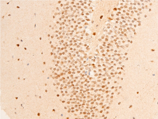 GSK3B / GSK3 Beta Antibody - 1:100 staining mouse brain tissue by IHC-P. The tissue was formaldehyde fixed and a heat mediated antigen retrieval step in citrate buffer was performed. The tissue was then blocked and incubated with the antibody for 1.5 hours at 22°C. An HRP conjugated goat anti-rabbit antibody was used as the secondary.