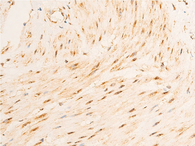 GSK3B / GSK3 Beta Antibody - 1:100 staining human gastric tissue by IHC-P. The tissue was formaldehyde fixed and a heat mediated antigen retrieval step in citrate buffer was performed. The tissue was then blocked and incubated with the antibody for 1.5 hours at 22°C. An HRP conjugated goat anti-rabbit antibody was used as the secondary.