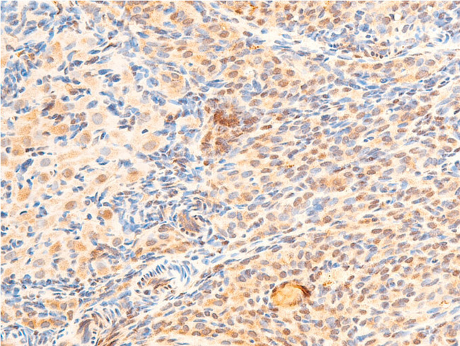 GSK3B / GSK3 Beta Antibody - 1:100 staining rat ovarian tissue by IHC-P. The tissue was formaldehyde fixed and a heat mediated antigen retrieval step in citrate buffer was performed. The tissue was then blocked and incubated with the antibody for 1.5 hours at 22°C. An HRP conjugated goat anti-rabbit antibody was used as the secondary.