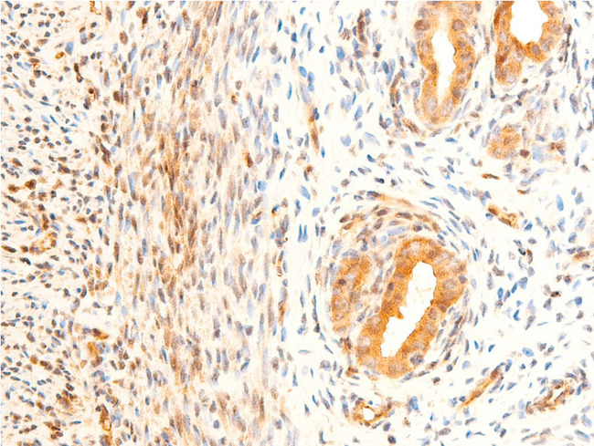 GSK3B / GSK3 Beta Antibody - 1:100 staining rat uterine tissue by IHC-P. The tissue was formaldehyde fixed and a heat mediated antigen retrieval step in citrate buffer was performed. The tissue was then blocked and incubated with the antibody for 1.5 hours at 22°C. An HRP conjugated goat anti-rabbit antibody was used as the secondary.