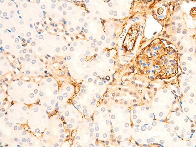 GSK3B / GSK3 Beta Antibody - 1:100 staining mouse kidney tissue by IHC-P. The tissue was formaldehyde fixed and a heat mediated antigen retrieval step in citrate buffer was performed. The tissue was then blocked and incubated with the antibody for 1.5 hours at 22°C. An HRP conjugated goat anti-rabbit antibody was used as the secondary.