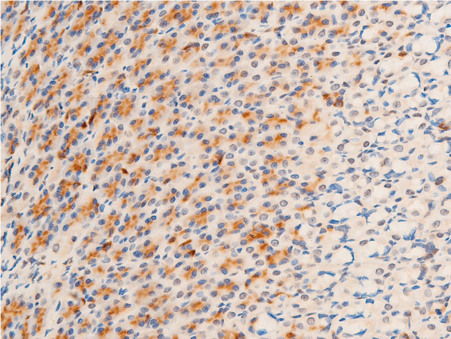 GSK3B / GSK3 Beta Antibody - 1:100 staining rat gastric tissue by IHC-P. The tissue was formaldehyde fixed and a heat mediated antigen retrieval step in citrate buffer was performed. The tissue was then blocked and incubated with the antibody for 1.5 hours at 22°C. An HRP conjugated goat anti-rabbit antibody was used as the secondary.