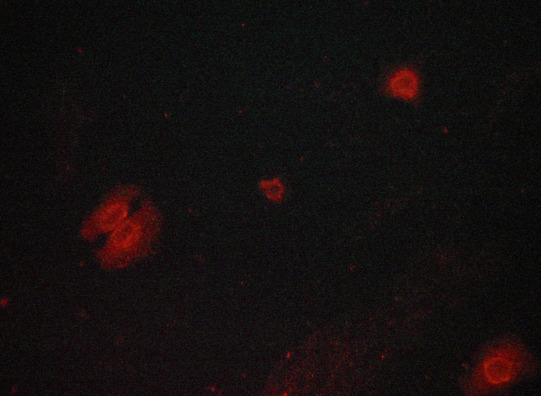 GSK3B / GSK3 Beta Antibody - Staining LOVO cells by IF/ICC. The samples were fixed with PFA and permeabilized in 0.1% saponin prior to blocking in 10% serum for 45 min at 37°C. The primary antibody was diluted 1/400 and incubated with the sample for 1 hour at 37°C. A Alexa Fluor® 594 conjugated goat polyclonal to rabbit IgG (H+L), diluted 1/600 was used as secondary antibody.