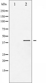 GSK3B / GSK3 Beta Antibody - Western blot analysis of extracts of various tissue sample using Phospho-GSK3 beta (Ser9) antibody.
