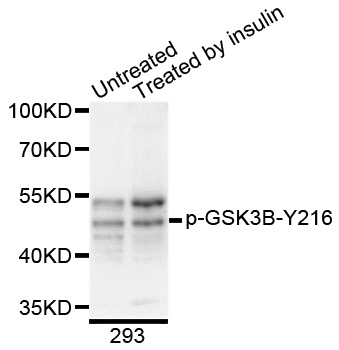 GSK3B / GSK3 Beta Antibody - Western blot analysis of extracts of 293 cells.