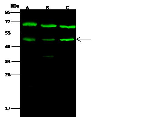 GSK3B / GSK3 Beta Antibody - Anti-GSK3B rabbit polyclonal antibody at 1:500 dilution. Lane A: MCF7 Whole Cell Lysate. Lane B: A549 Whole Cell Lysate. Lane C: Jurkat Whole Cell Lysate. Lysates/proteins at 30 ug per lane. Secondary: Goat Anti-Rabbit IgG H&L (Dylight 800) at 1/10000 dilution. Developed using the Odyssey technique. Performed under reducing conditions. Predicted band size: 47 kDa. Observed band size: 49 kDa. (We are unsure as to the identity of these extra bands.)