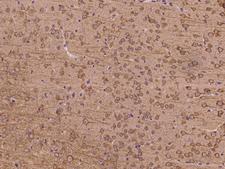 GSK3B / GSK3 Beta Antibody - Immunochemical staining of mouse GSK3B in mouse brain with rabbit polyclonal antibody at 1:200 dilution, formalin-fixed paraffin embedded sections.