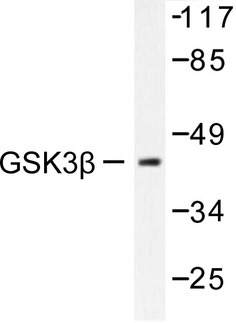 GSK3B / GSK3 Beta Antibody - Western blot of GSK3 (S2) pAb in extracts from 293 cells treated with serum 10% 15 or from Jurkat cells treated with Insulin 0.01U/ml 15.