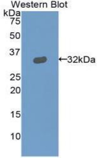GSN / Gelsolin Antibody - Western blot of recombinant GSN / Gelsolin.  This image was taken for the unconjugated form of this product. Other forms have not been tested.