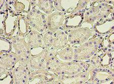 GSN / Gelsolin Antibody - Immunohistochemistry of paraffin-embedded human kidney using antibody at 1:100 dilution.  This image was taken for the unconjugated form of this product. Other forms have not been tested.