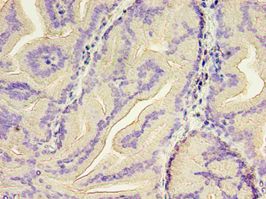 GSN / Gelsolin Antibody - Immunohistochemistry of paraffin-embedded human prostate using antibody at 1:100 dilution.  This image was taken for the unconjugated form of this product. Other forms have not been tested.