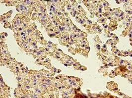GSN / Gelsolin Antibody - Immunohistochemistry of paraffin-embedded human lung using antibody at 1:100 dilution.  This image was taken for the unconjugated form of this product. Other forms have not been tested.
