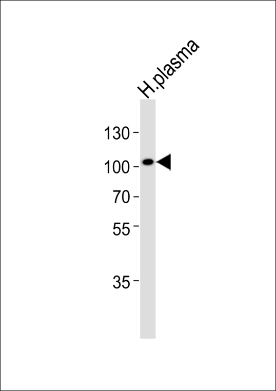 GSN / Gelsolin Antibody - Western blot of lysate from human plasma tissue lysate with GSN Antibody. Antibody was diluted at 1:1000. A goat anti-rabbit IgG H&L (HRP) at 1:5000 dilution was used as the secondary antibody. Lysate at 35 ug.