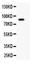 GSN / Gelsolin Antibody - Gelsolin antibody Western blot. All lanes: Anti Gelsolin at 0.5 ug/ml. WB: A431 Whole Cell Lysate at 40 ug. Predicted band size: 86 kD. Observed band size: 86 kD.