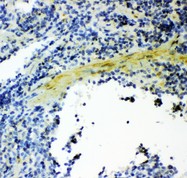GSN / Gelsolin Antibody - Gelsolin antibody IHC-paraffin: Mouse Spleen Tissue.