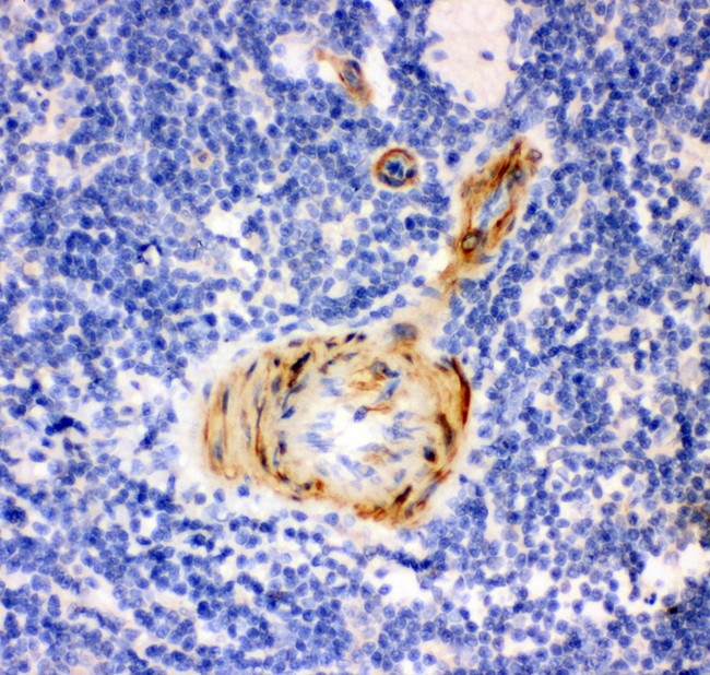 GSN / Gelsolin Antibody - Gelsolin antibody IHC-paraffin: Rat Spleen Tissue.