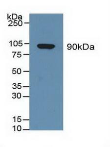 GSN / Gelsolin Antibody - Western Blot; Sample: Human Serum.