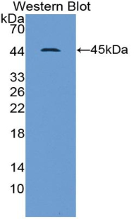 GSN / Gelsolin Antibody - Western blot of recombinant GSN / Gelsolin.