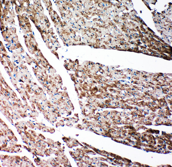 GSN / Gelsolin Antibody - GSN / Gelsolin antibody. IHC(P): Rat Cardiac Muscle Tissue.