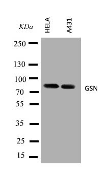 GSN / Gelsolin Antibody - WB of GSN / Gelsolin antibody. Lane 1: HELA Cell Lysate. Lane 2: A431 Cell Lysate.