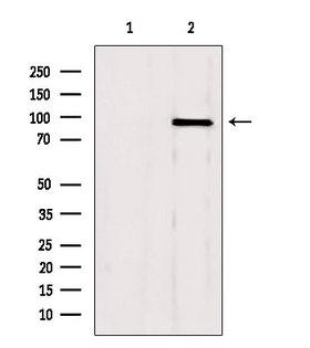 GSN / Gelsolin Antibody - Western blot analysis of extracts of mouse brain tissue using GSN antibody. Lane 1 was treated with the blocking peptide.