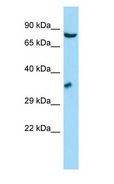 GSPT Antibody - GSPT antibody Western Blot of HepG2.  This image was taken for the unconjugated form of this product. Other forms have not been tested.