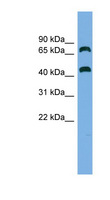 GSPT Antibody - GSPT2 antibody Western blot of ACHN lysate. This image was taken for the unconjugated form of this product. Other forms have not been tested.