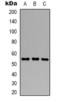 GSPT1 Antibody - Western blot analysis of GSPT1 expression in HeLa (A); HepG2 (B); NIH3T3 (C) whole cell lysates.