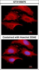 GSPT1 Antibody - Immunofluorescence of methanol-fixed HeLa, using GSPT1 antibody at 1:500 dilution.