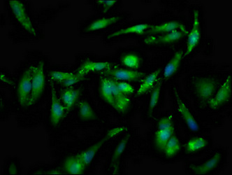GSPT1 Antibody - Immunofluorescence staining of Hela cells at a dilution of 1:133, counter-stained with DAPI. The cells were fixed in 4% formaldehyde, permeabilized using 0.2% Triton X-100 and blocked in 10% normal Goat Serum. The cells were then incubated with the antibody overnight at 4 °C.The secondary antibody was Alexa Fluor 488-congugated AffiniPure Goat Anti-Rabbit IgG (H+L) .