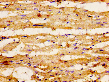 GSPT1 Antibody - Immunohistochemistry image at a dilution of 1:400 and staining in paraffin-embeddedhuman heart tissue performed on a Leica BondTM system. After dewaxing and hydration, antigen retrieval was mediated by high pressure in a citrate buffer (pH 6.0) . Section was blocked with 10% normal goat serum 30min at RT. Then primary antibody (1% BSA) was incubated at 4 °C overnight. The primary is detected by a biotinylated secondary antibody and visualized using an HRP conjugated ABC system.