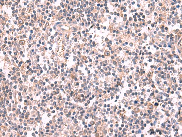 GSPT2 Antibody - Immunohistochemistry of paraffin-embedded Human tonsil tissue  using GSPT2 Polyclonal Antibody at dilution of 1:50(×200)