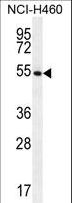 GSR / Glutathione Reductase Antibody - GSR Antibody western blot of NCI-H460 cell line lysates (35 ug/lane). The GSR antibody detected the GSR protein (arrow).