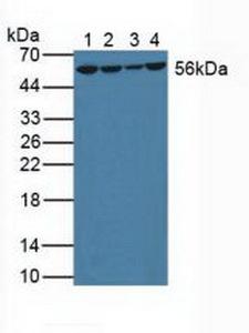 GSR / Glutathione Reductase Antibody - Western Blot; Sample: Lane1: Human Liver Tissue; Lane2: Human Lung Tissue; Lane3: Human Hela Cells.