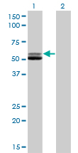 GSR / Glutathione Reductase Antibody - Western blot of GSR expression in transfected 293T cell line by GSR monoclonal antibody (M01), clone 6B4.