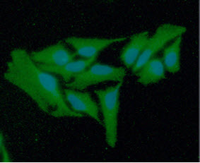 GSR / Glutathione Reductase Antibody - ICC/IF analysis of GSR in HeLa cells line, stained with DAPI (Blue) for nucleus staining and monoclonal anti-human GSR antibody (1:100) with goat anti-mouse IgG-Alexa fluor 488 conjugate (Green).