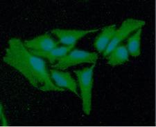 GSR / Glutathione Reductase Antibody - ICC/IF analysis of GSR in HeLa cells line, stained with DAPI (Blue) for nucleus staining and monoclonal anti-human GSR antibody (1:100) with goat anti-mouse IgG-Alexa fluor 488 conjugate (Green).