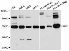 GSR / Glutathione Reductase Antibody - Western blot analysis of extracts of various cell lines, using GSR antibody at 1:3000 dilution. The secondary antibody used was an HRP Goat Anti-Rabbit IgG (H+L) at 1:10000 dilution. Lysates were loaded 25ug per lane and 3% nonfat dry milk in TBST was used for blocking. An ECL Kit was used for detection and the exposure time was 10s.