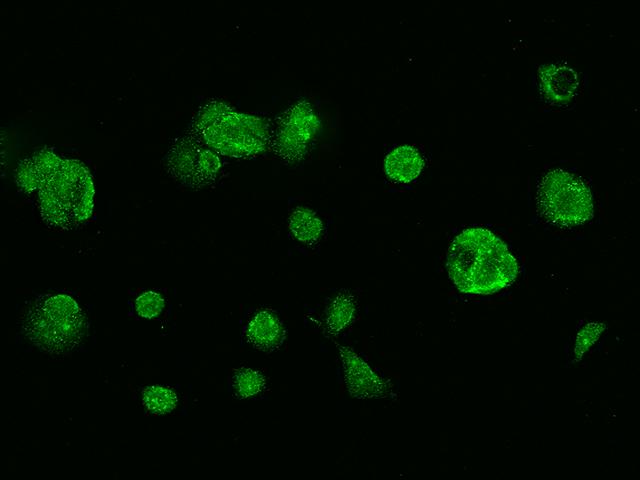 GSR / Glutathione Reductase Antibody - Immunofluorescence staining of GSR in MCF7 cells. Cells were fixed with 4% PFA, permeabilzed with 0.1% Triton X-100 in PBS, blocked with 10% serum, and incubated with rabbit anti-human GSR polyclonal antibody (dilution ratio 1:1000) at 4°C overnight. Then cells were stained with the Alexa Fluor 488-conjugated Goat Anti-rabbit IgG secondary antibody (green). Positive staining was localized to Cytoplasm.